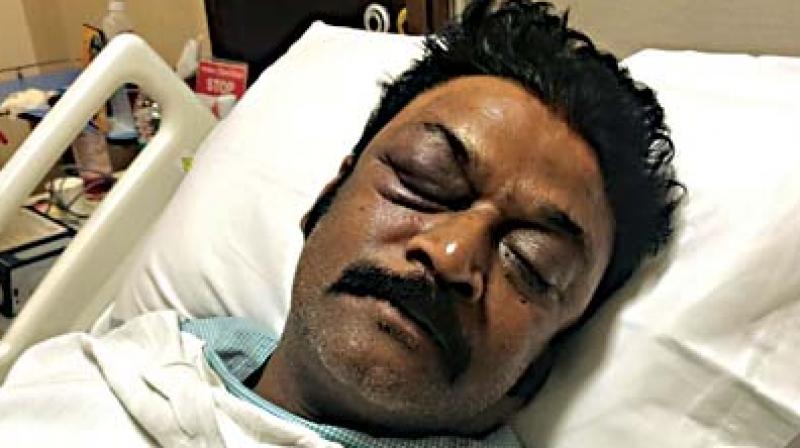 Ganesh had allegedly attacked Singh (in picture) with his fists and a flowerpot hit him near his eye and kicked him on his chest, according to the complaint filed with the police. (Photo: File) Ganesh had allegedly attacked Singh (in picture) with his fists and a flowerpot hit him near his eye and kicked him on his chest, according to the complaint filed with the police. (Photo: File)
