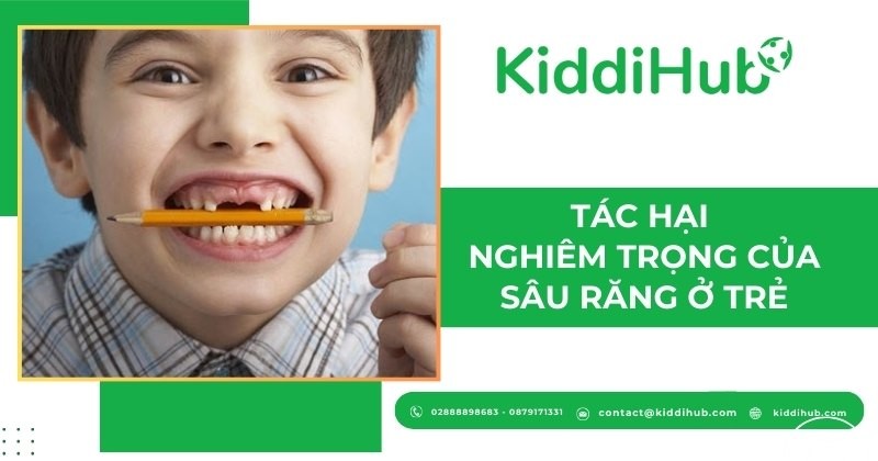 Tác hại nghiêm trọng của sâu răng ở trẻ