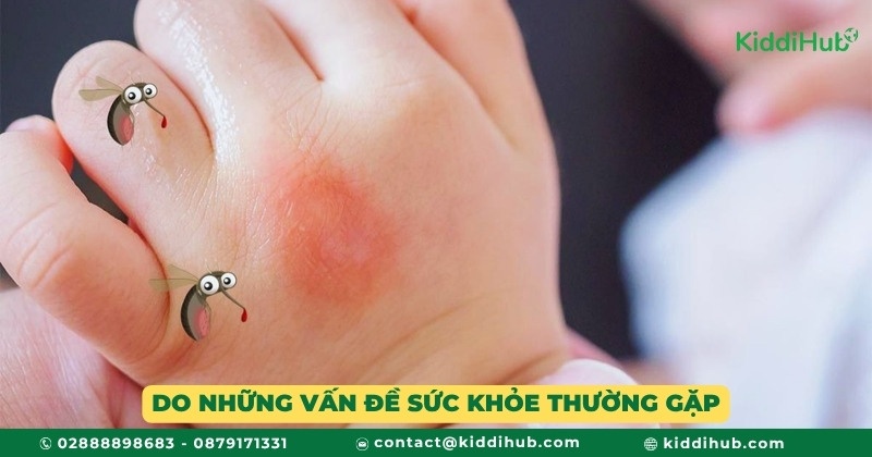 Do những vấn đề sức khỏe thường gặp