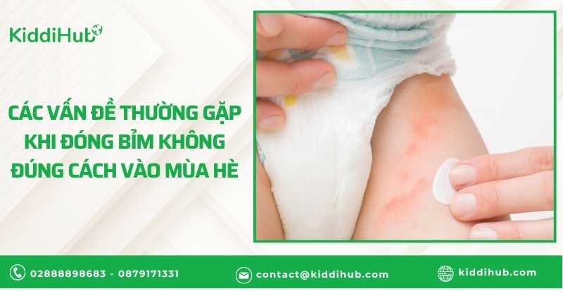 Các vấn đề thường gặp khi đóng bỉm không đúng cách vào mùa hè