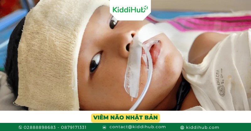 Viêm não Nhật Bản