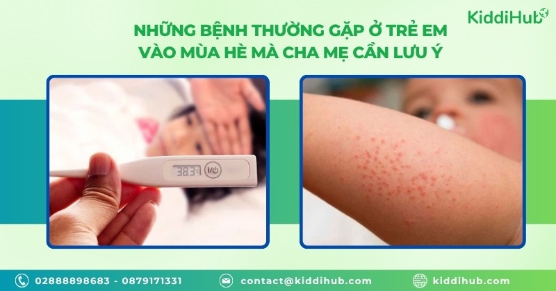 Những bệnh thường gặp ở trẻ em vào mùa hè mà cha mẹ cần lưu ý