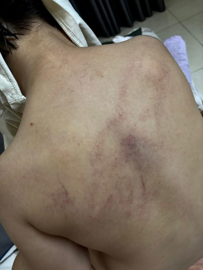 Sự việc giáo viên bị tố bạo hành tại Trường mầm non Gia Thụy Phường Bồ Đề