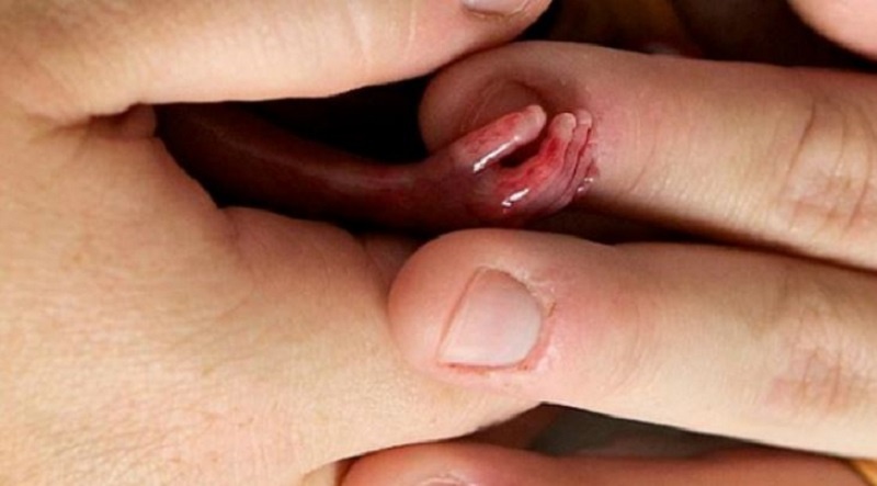 bi-say-thai-co-xui-khong