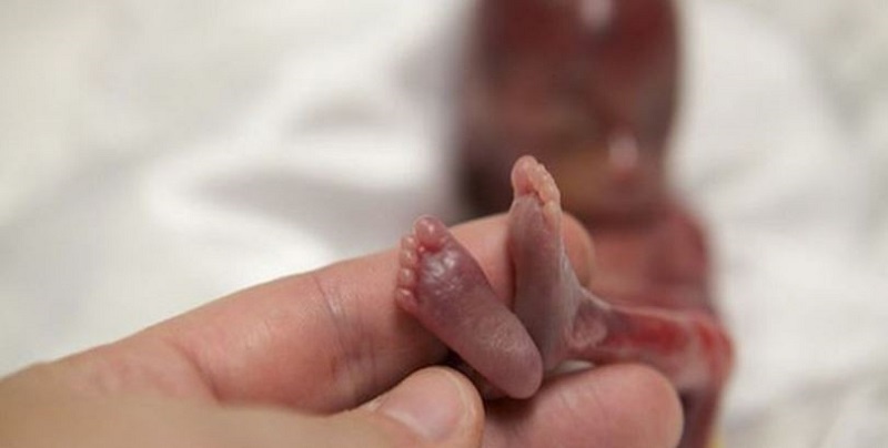 bi-say-thai-co-xui-khong