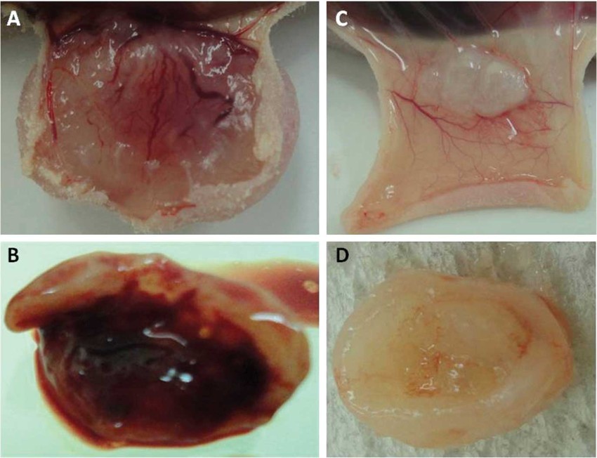 say-thai-an-gi-cho-ra-het-mau