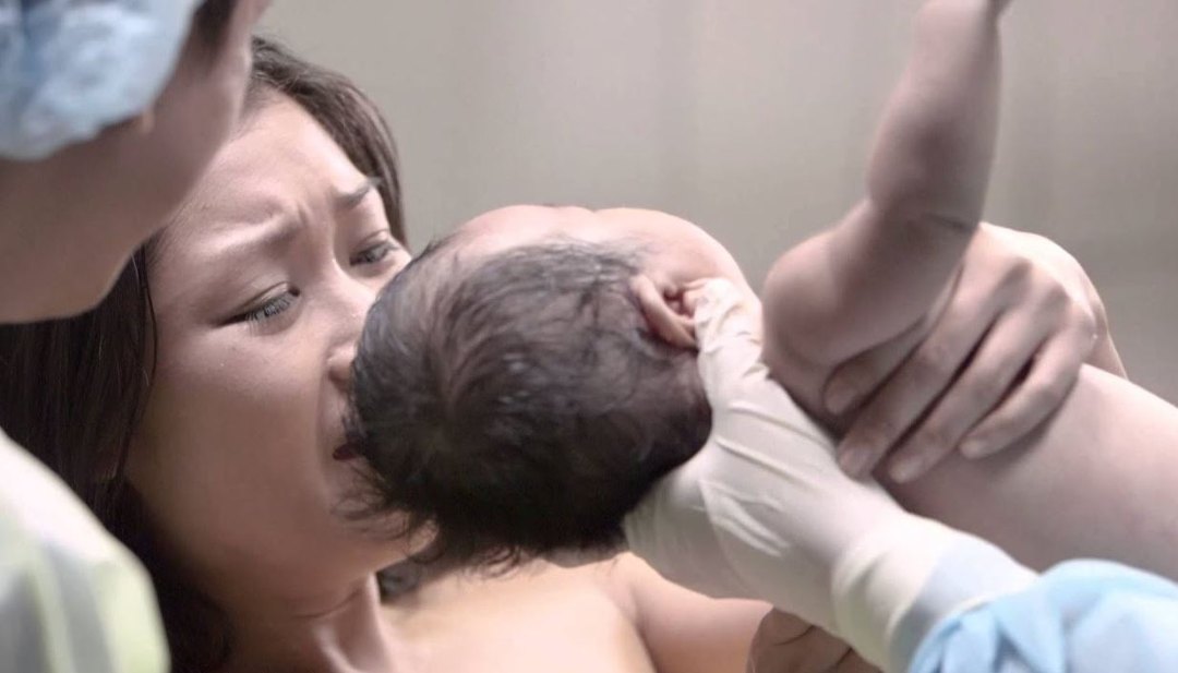 sinh-mo-lan-3-co-nguy-hiem-khong