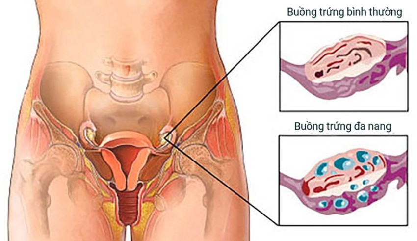 khong-co-dau-hieu-mang-thai
