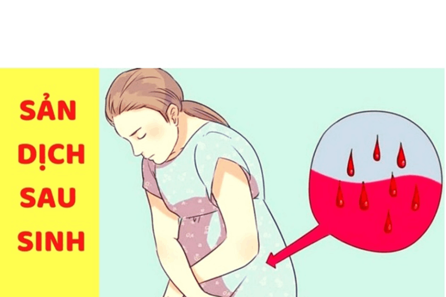 san-dich-sau-sinh-mo-bao-nhieu-ngay-thi-het