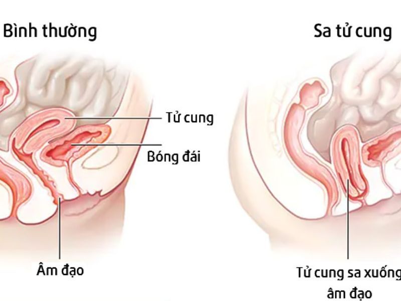 sa-tu-cung-co-quan-he-duoc-khong