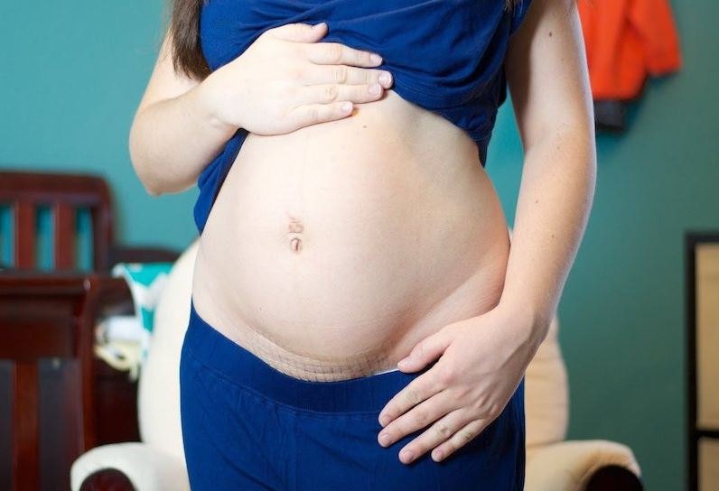 sinh-mo-lan-3-co-nguy-hiem-khong