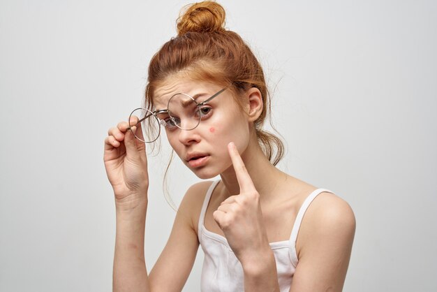 Cara hilangkan Parut Jerawat parut jerawat