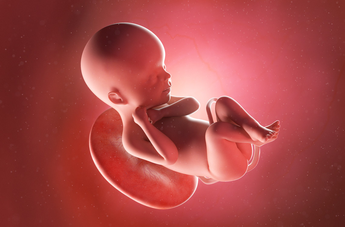 down-syndrome-baby