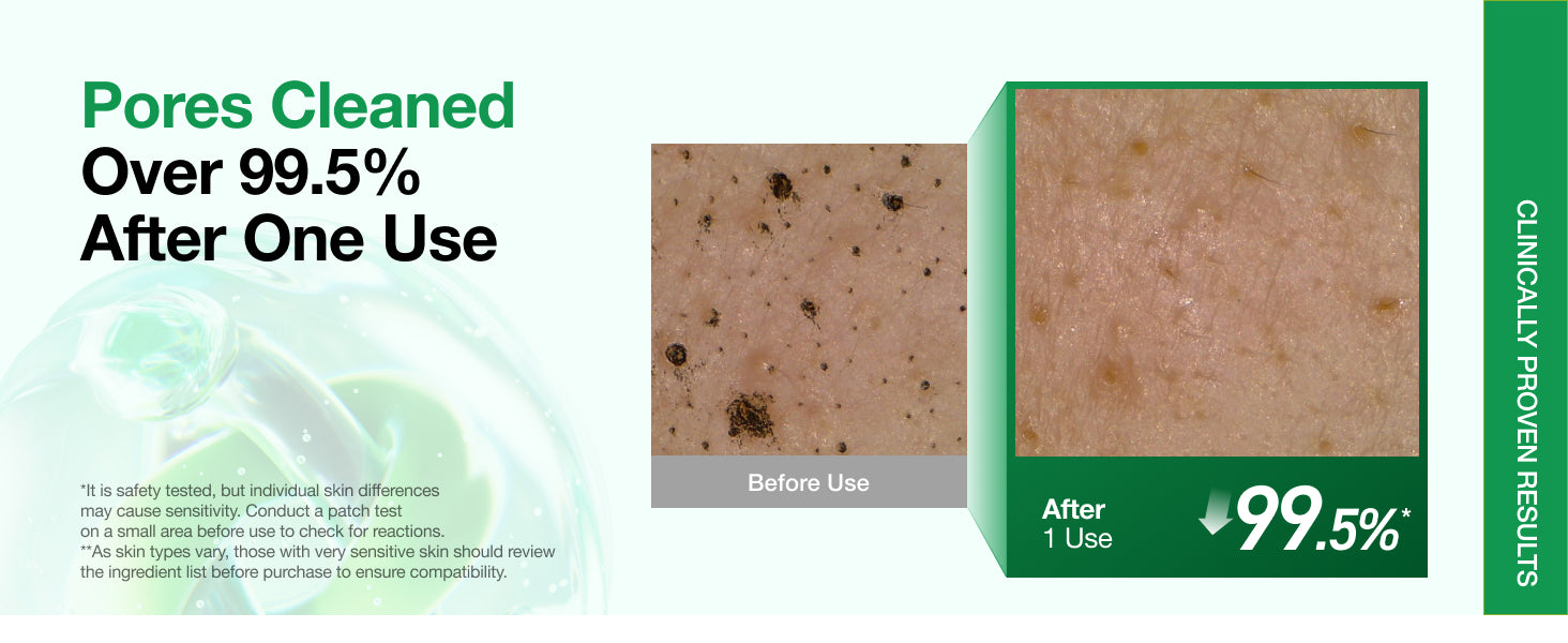 Heartleaf Deep Cleansing Foam detail 3