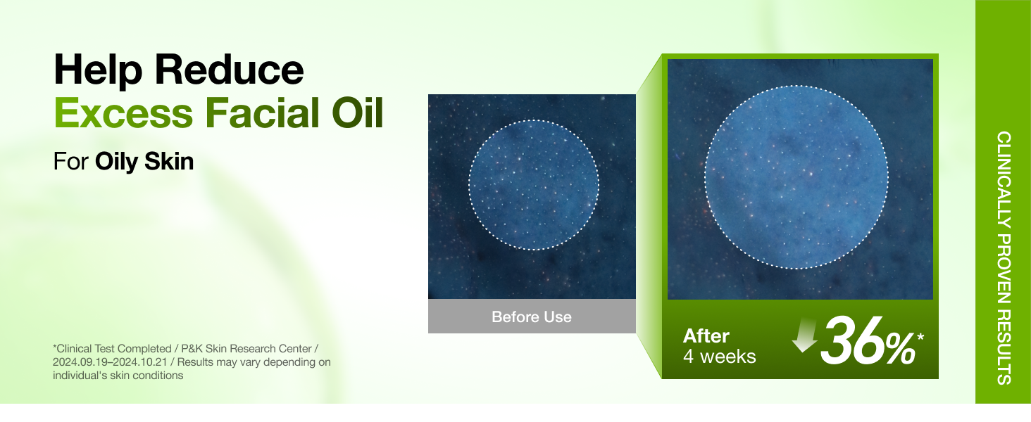 Azelaic Acid 10 Hyaluron Serum detail 9