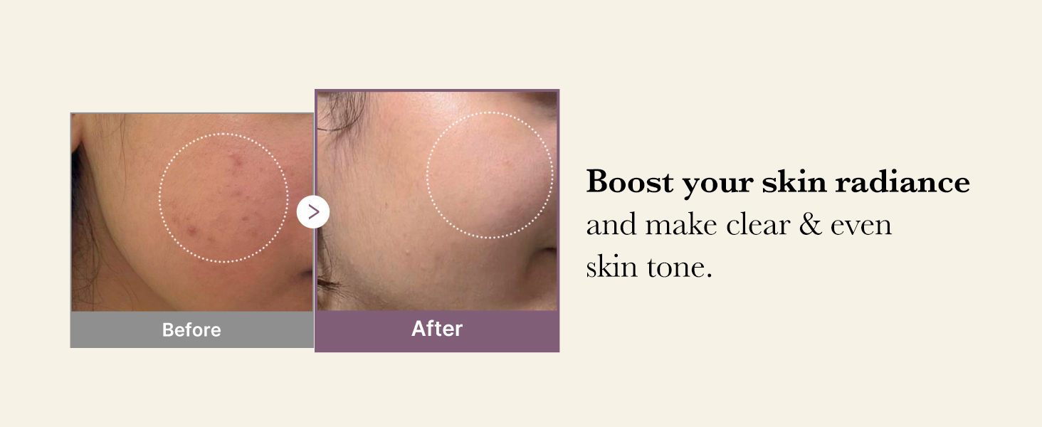 Age-R Glutathione Glow Milky Toner detail 2