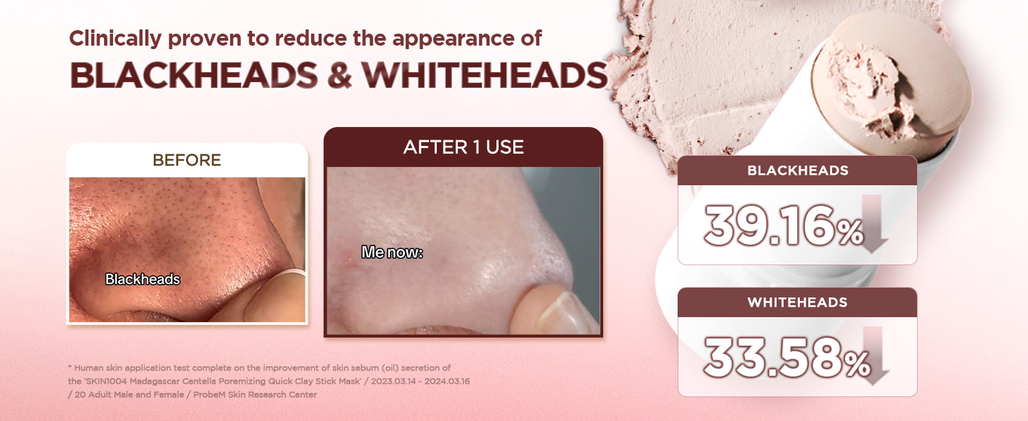 [Hudson's Pick] Poremizing Quick Clay Stick Mask detail 3