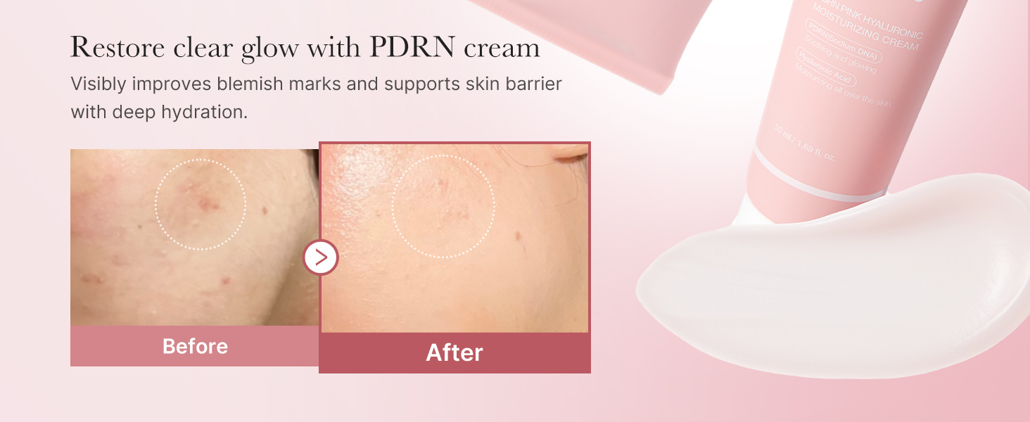 Salmon DNA PDRN Pink Hyaluronic Moisturizing Cream detail 4