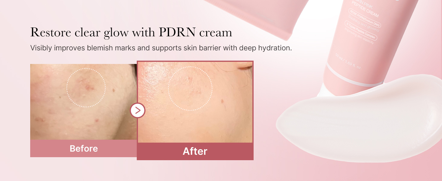 Rose PDRN Pink Hyaluronic Moisturizing Cream detail 4