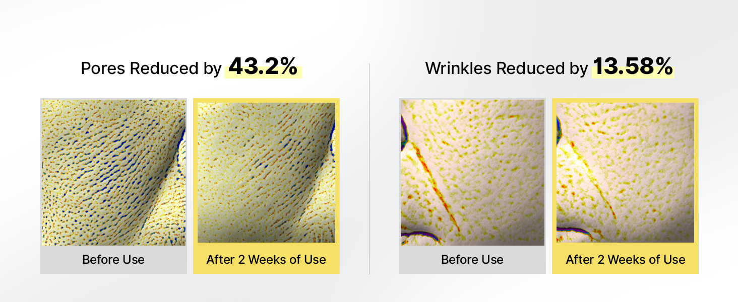 The Vita A Retinol Shot Tightening Serum detail 4