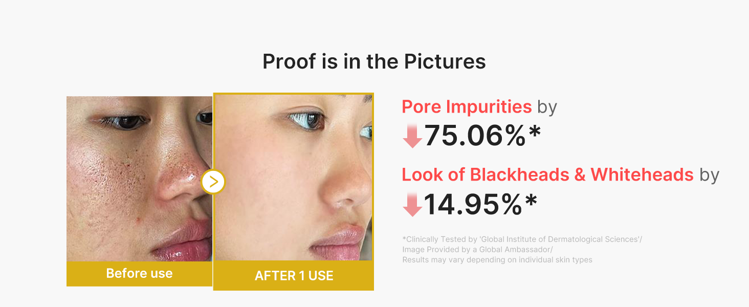 Peel Shot with Kojic Acid Turmeric for Troubled detail 4