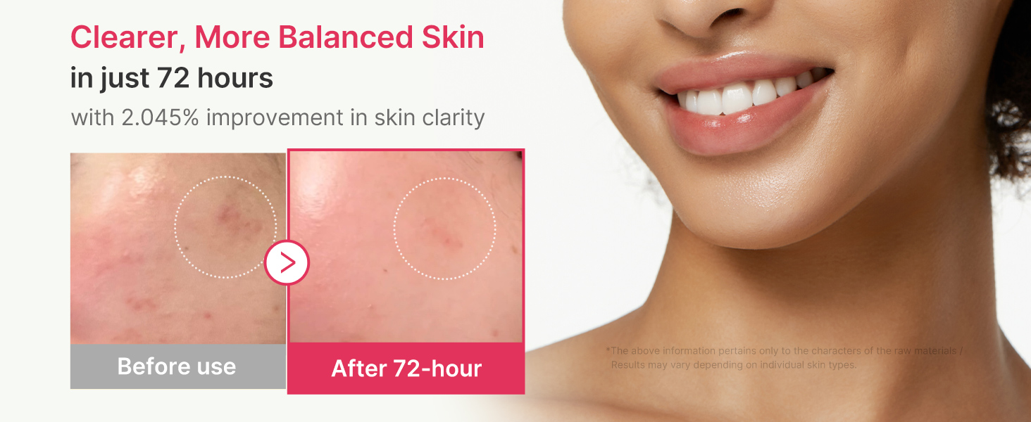 TXA&Niacinamide 15% Glow Serum detail 4