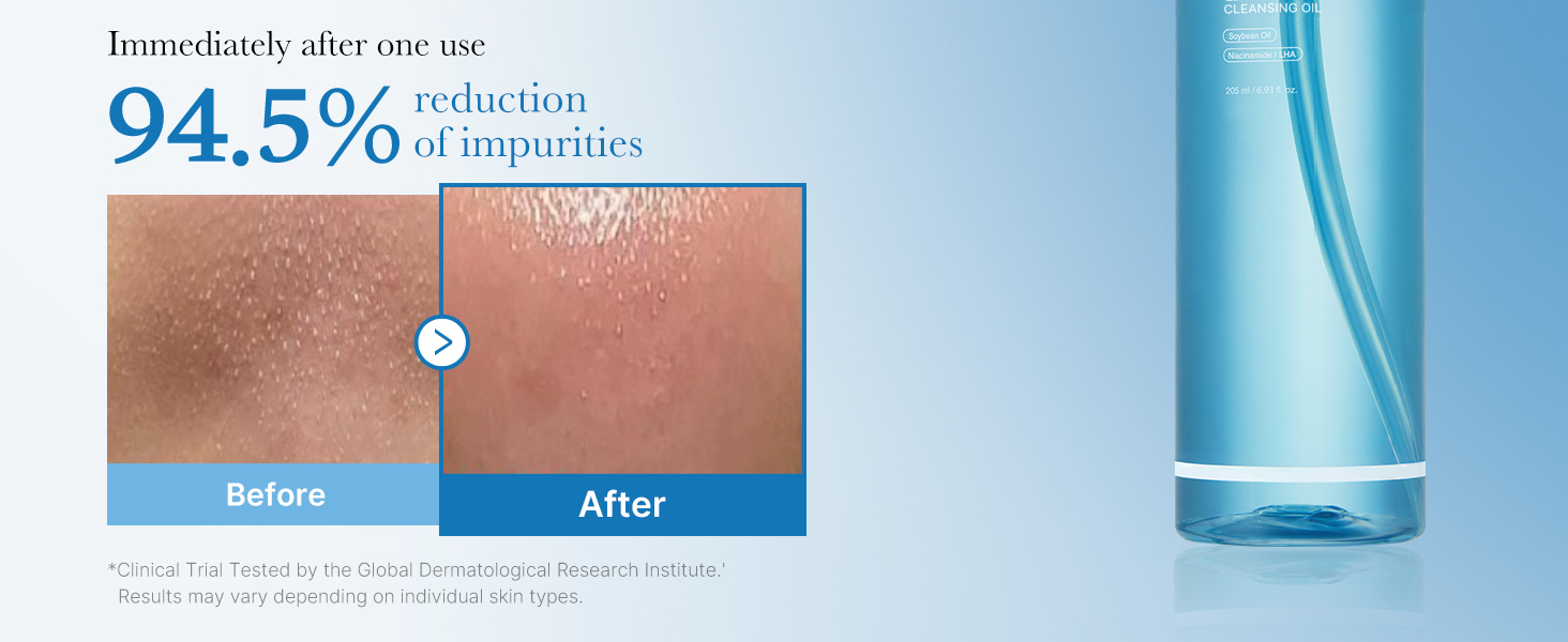 Cleansing Oil Zero Pore Blackhead detail 4