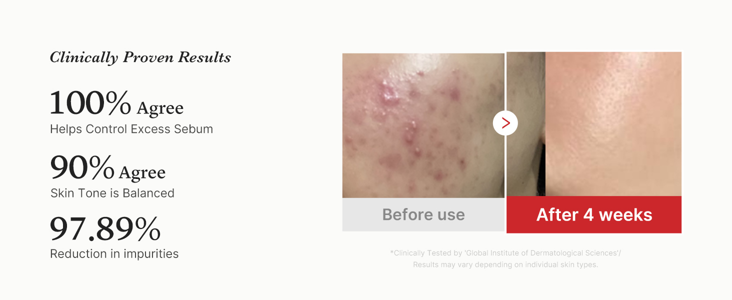 Toner Pads Red Succinic Acid Panthenol Pad for detail 4