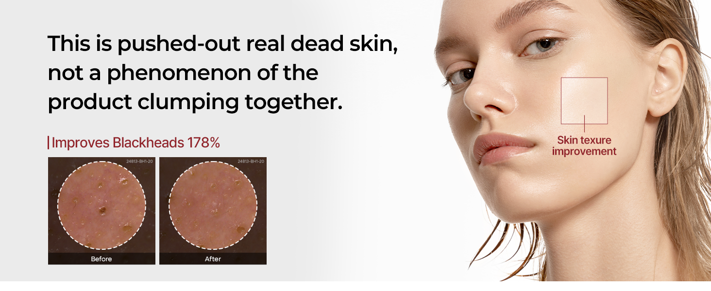 Peel Shot Black Rice Exfoliating Ampoule detail 4