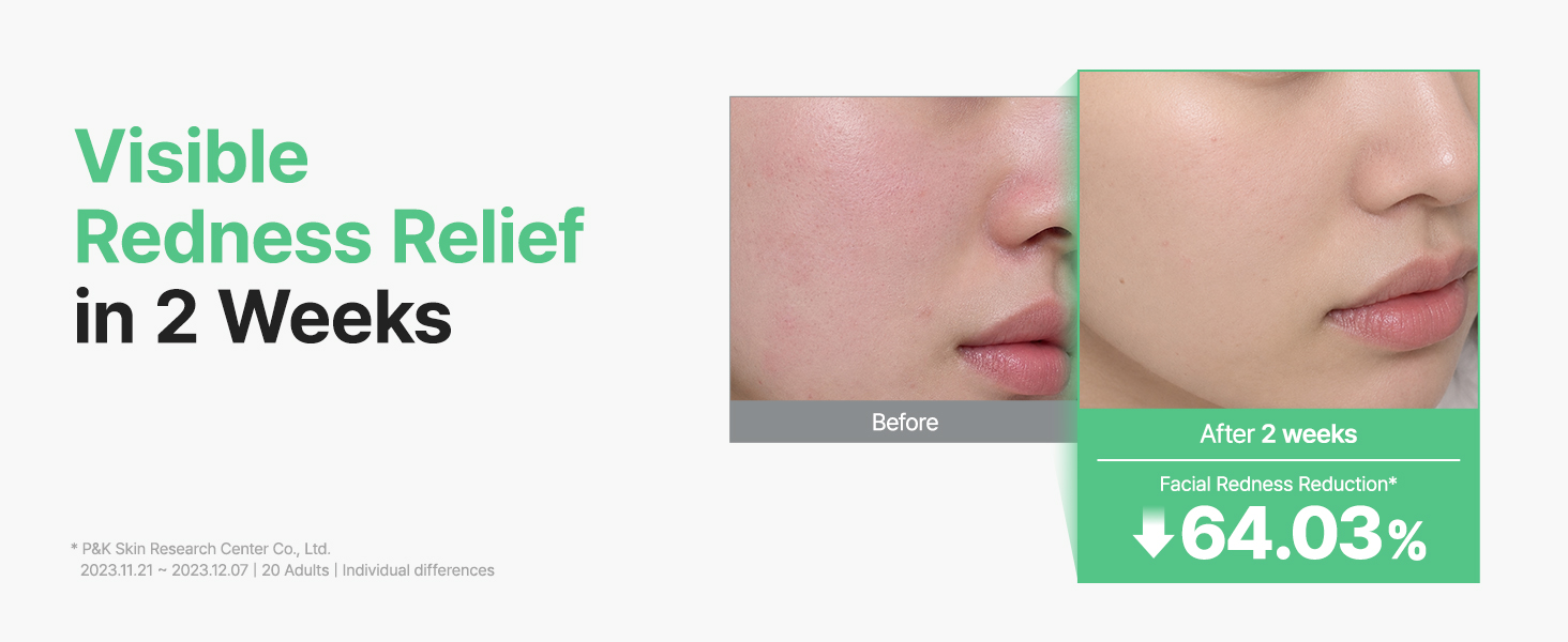 Centella Unscented Serum for Sensitive Skin detail 5