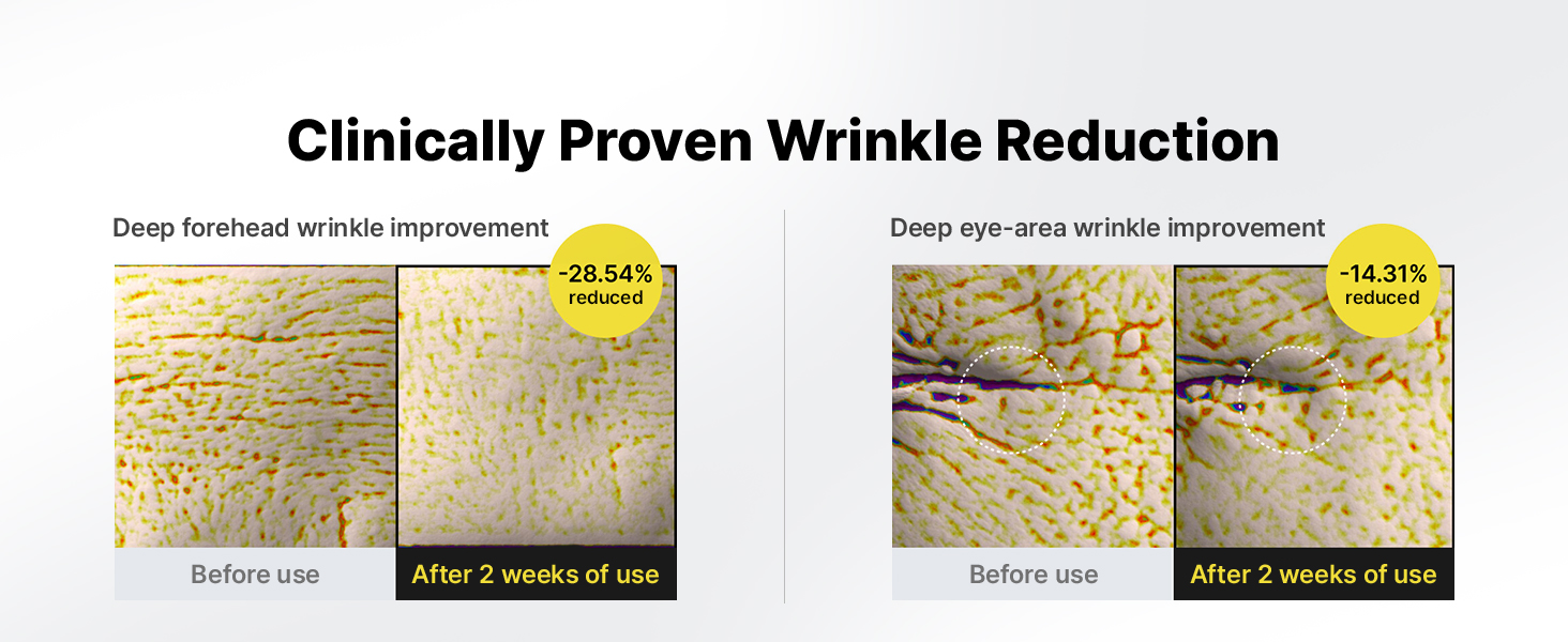 The Vita A Retinal Shot Tightening Booster detail 5