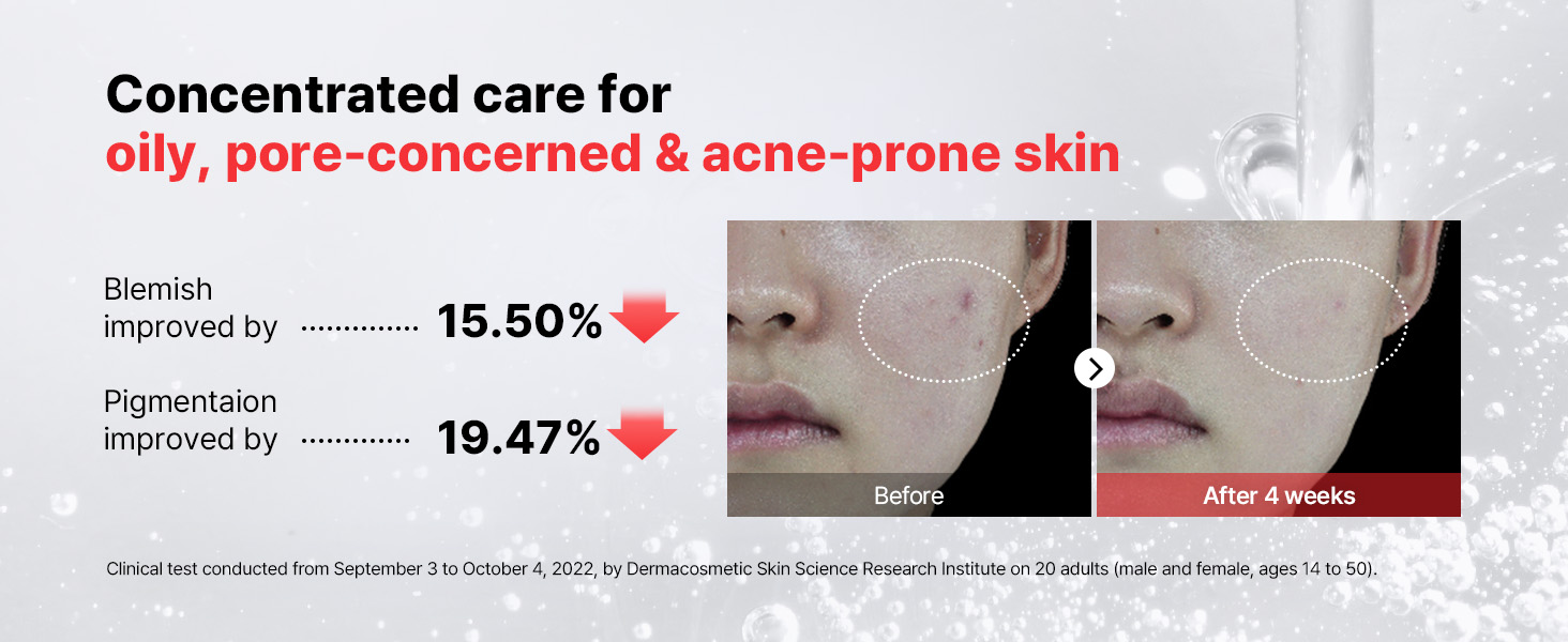 15% Niacinamide Face Serum detail 5