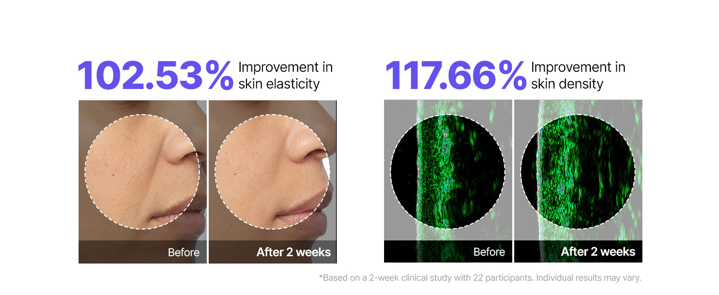 Deep Collagen Silk Peptide EGF Gold Overnight Mask detail 5
