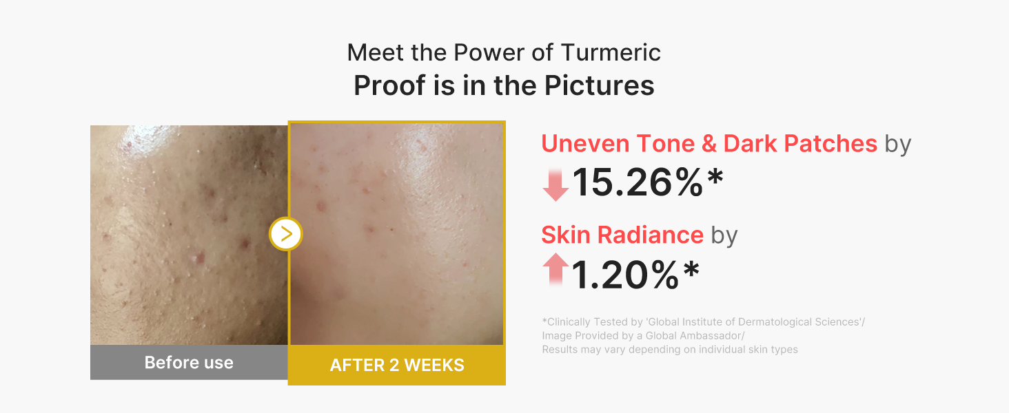Peel Shot with Kojic Acid Turmeric for Troubled detail 5
