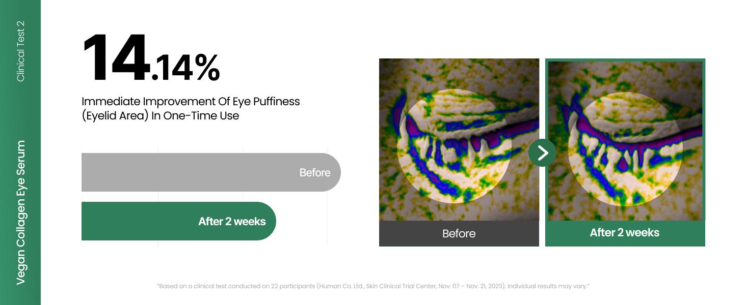 Vegan Collagen Eye Serum with 2% Niacinamide detail 5