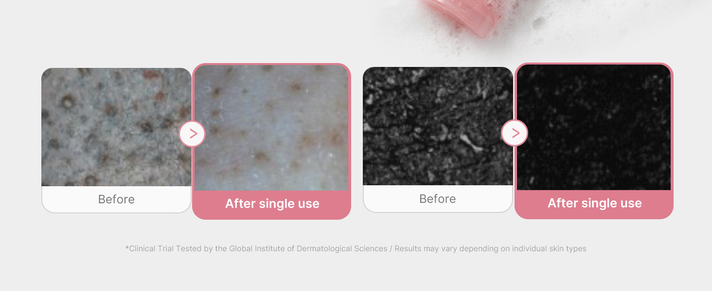 Facial Cleanser PDRN Pink Glutathione Capsule Foam Cleanser detail 4