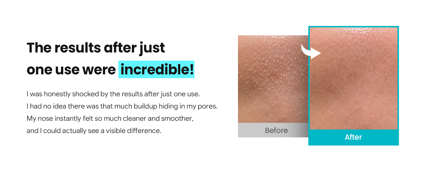 Melting Sebum Softener detail 5