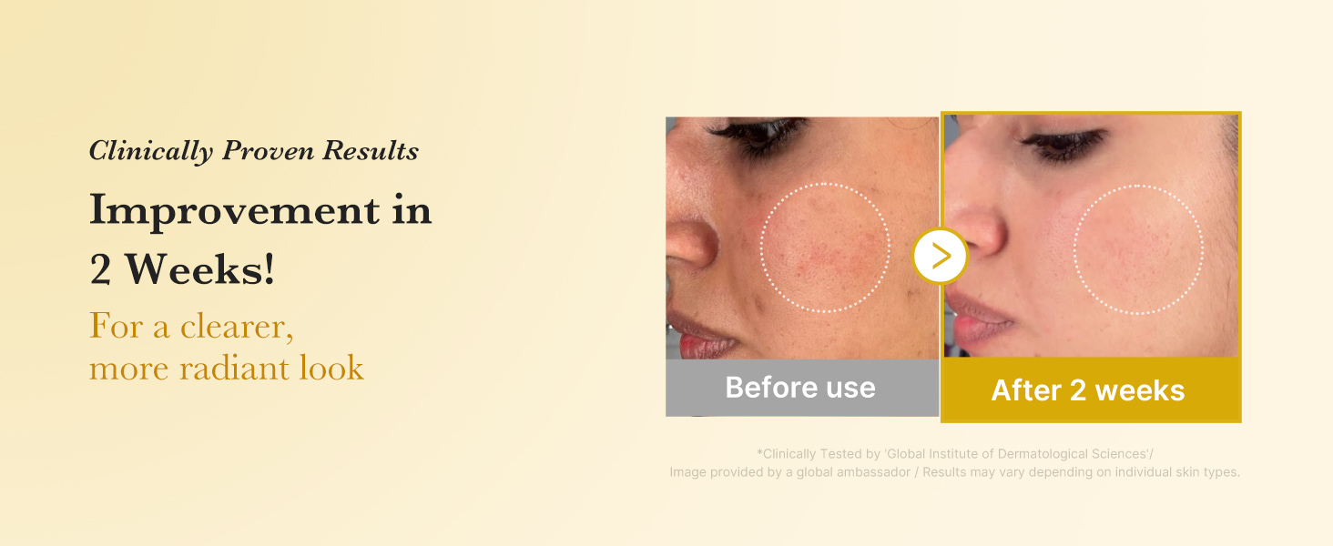 Kojic Acid Turmeric Smoothing Toner for Face & detail 5