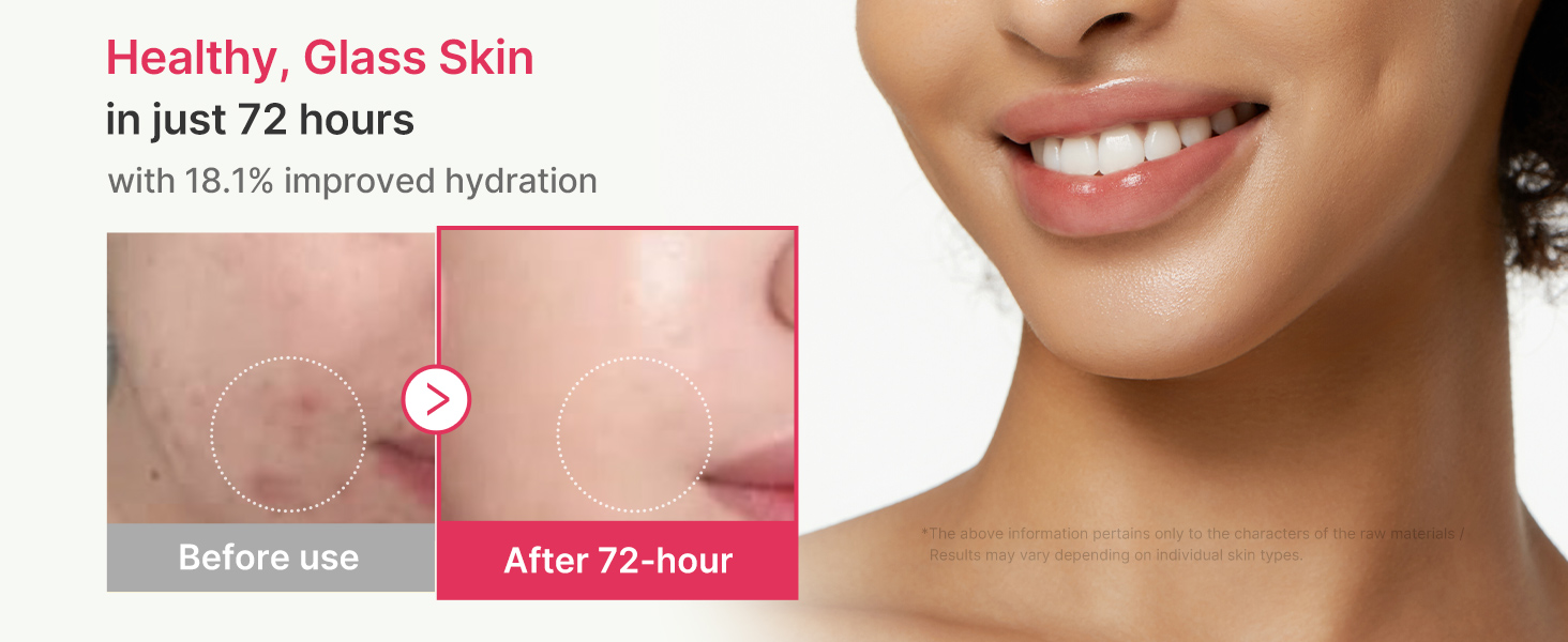 TXA&Niacinamide 15% Glow Serum detail 5