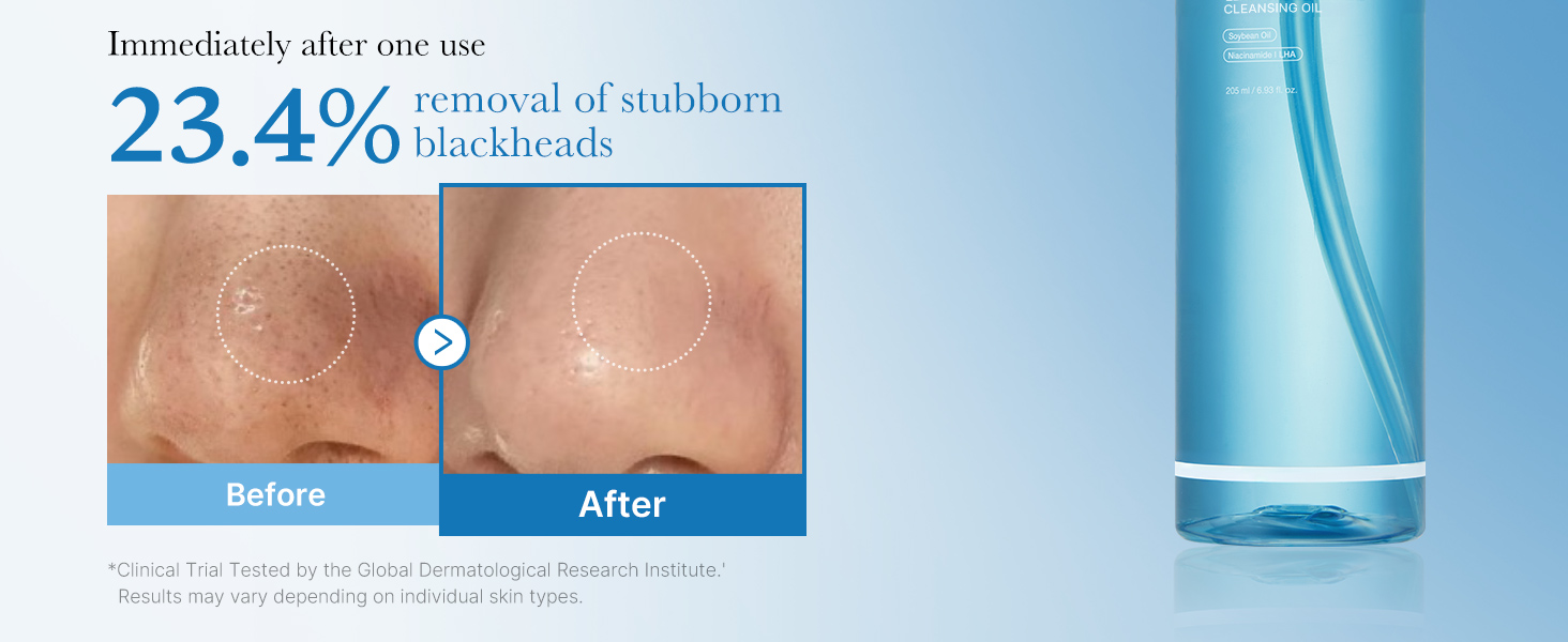 Cleansing Oil Zero Pore Blackhead detail 5
