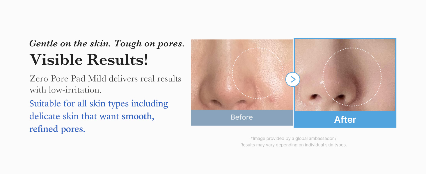 Toner Pads Zero Pore Pad Mild 2.0 for detail 5