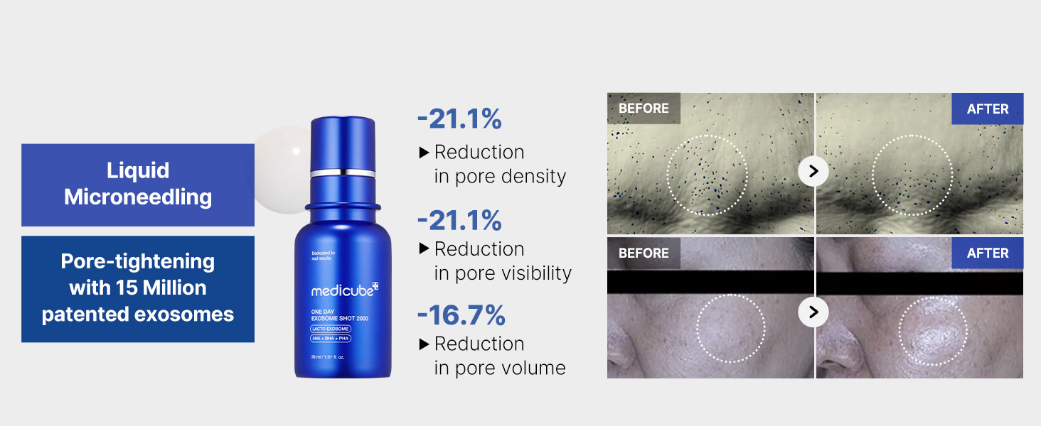 Exosome Shot Zero 2 detail 5