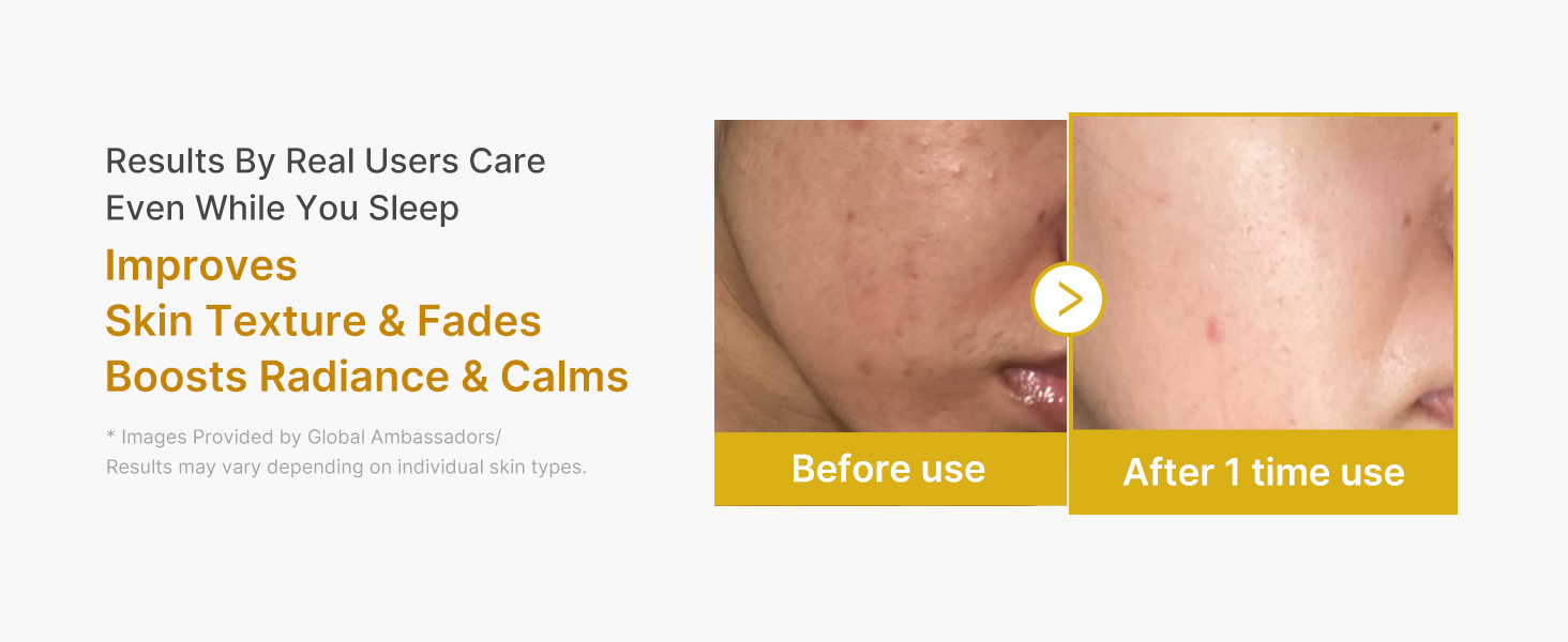 Wrapping Mask Kojic Acid Turmeric- Overnight Peel Off detail 5