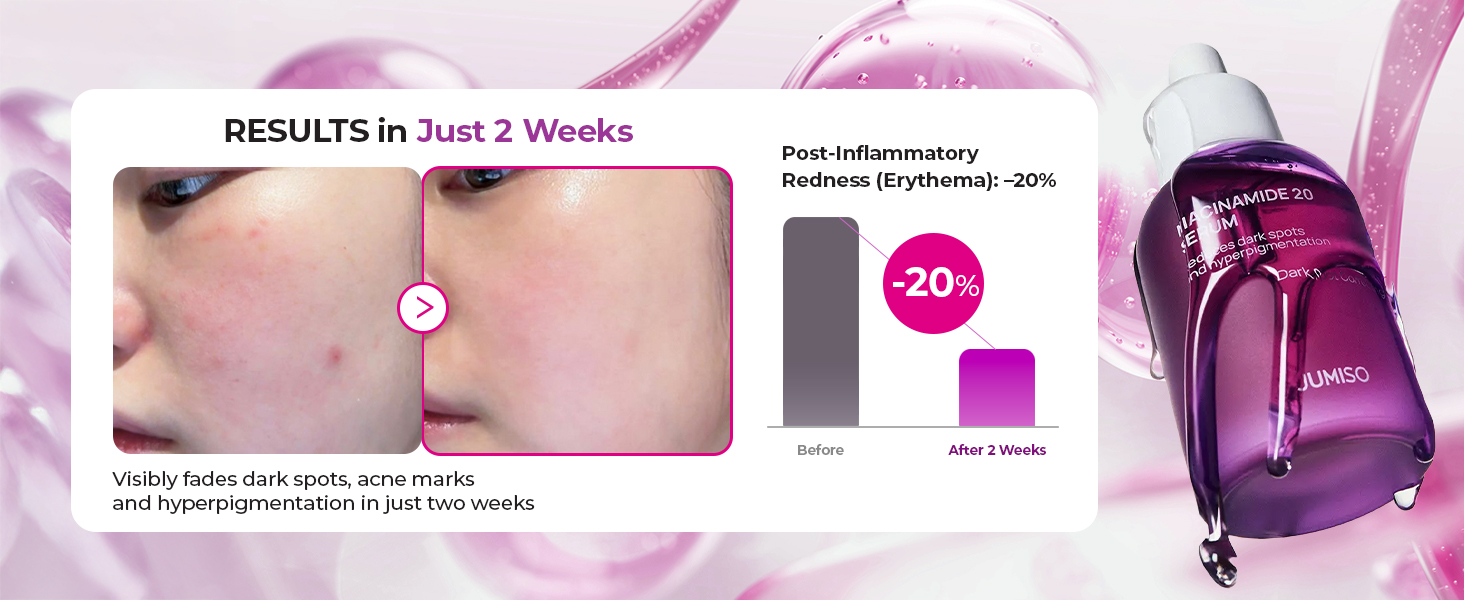 20% Niacinamide Dark Spot Correcting Serum for Face detail 6