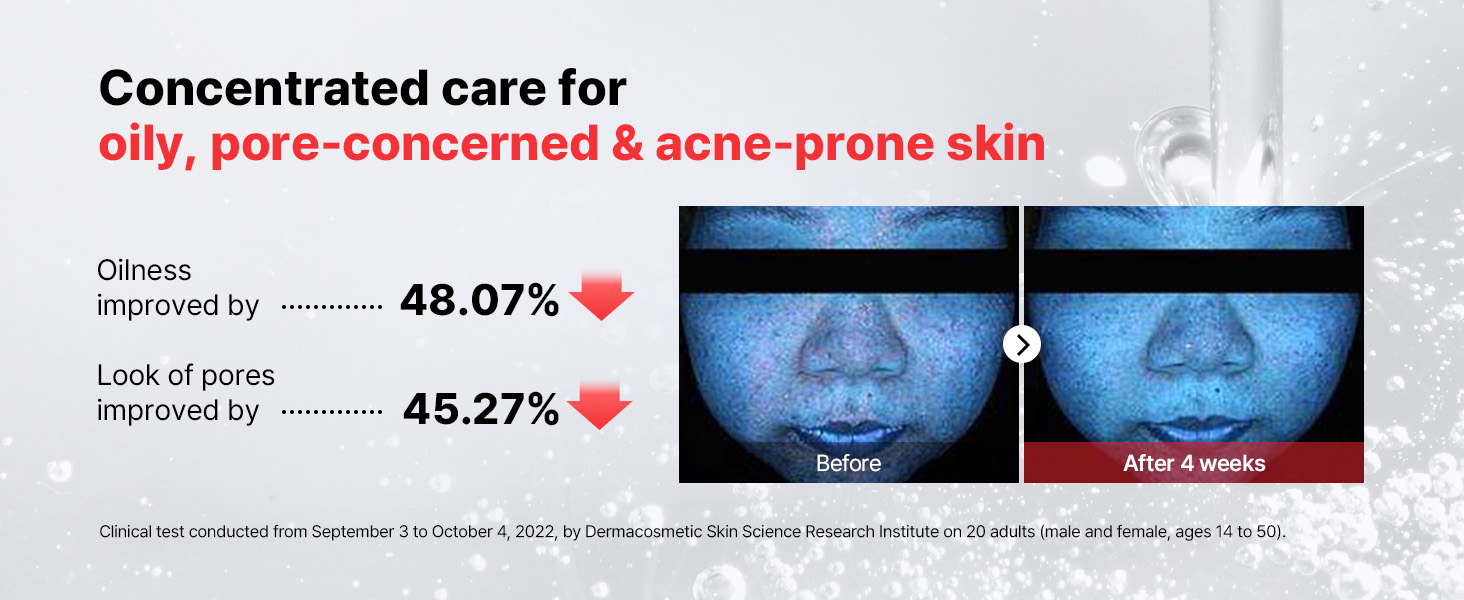 15% Niacinamide Face Serum detail 6