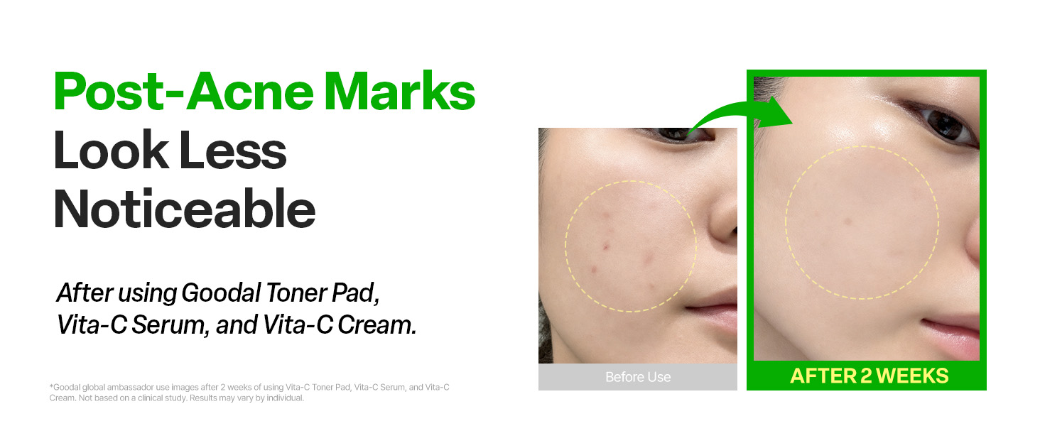 Vitamin C Dark spot brightening Serum detail 6