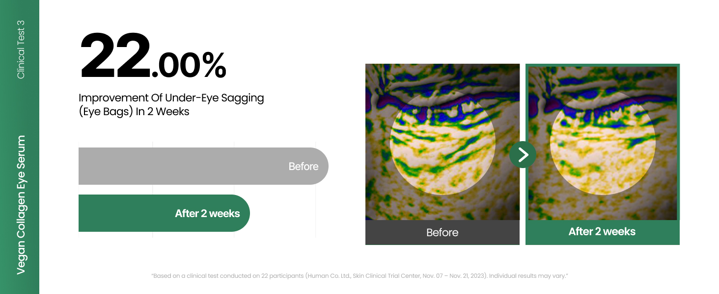 Vegan Collagen Eye Serum with 2% Niacinamide detail 6
