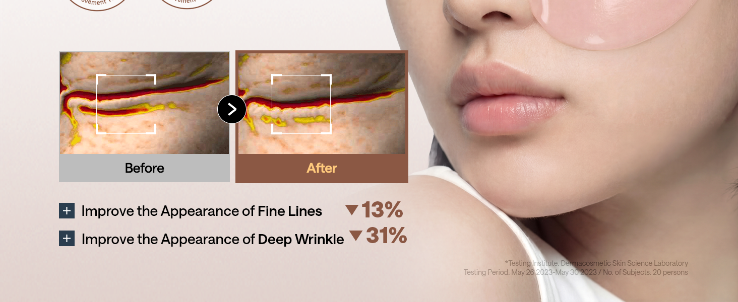 95% Retinol & Collagen Under Eye Patches detail 6