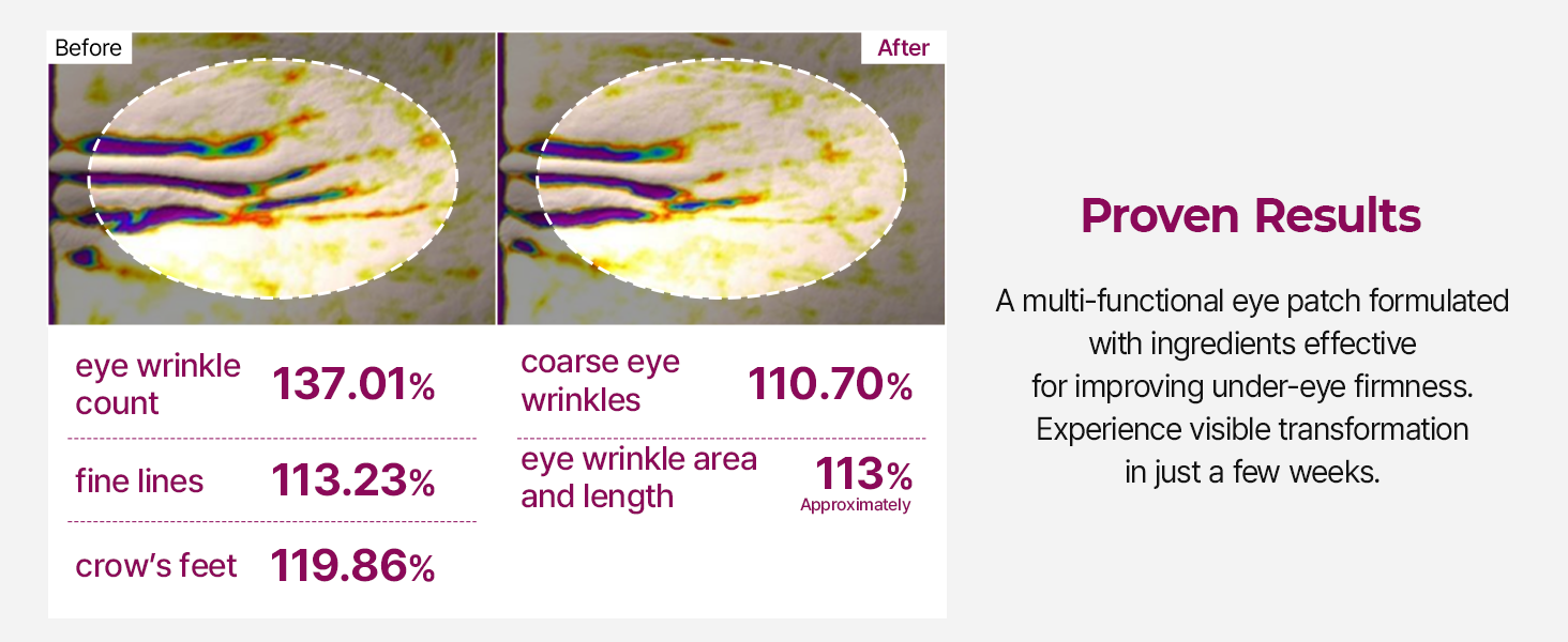 Calcium Volume Under Eye Patches for Puffy Eyes detail 6
