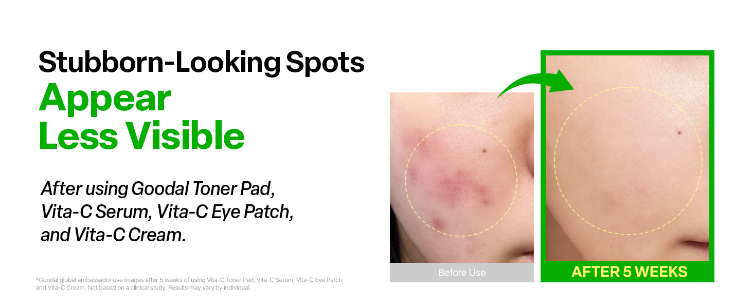 Vitamin C Dark spot brightening Serum detail 7